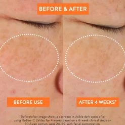 Radian-C Cream