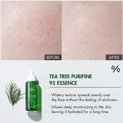 Tea Tree Purifine 95 Essence